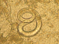 hjerteormpw1