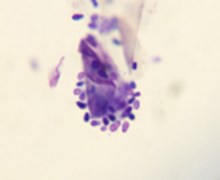 Mallazzecia